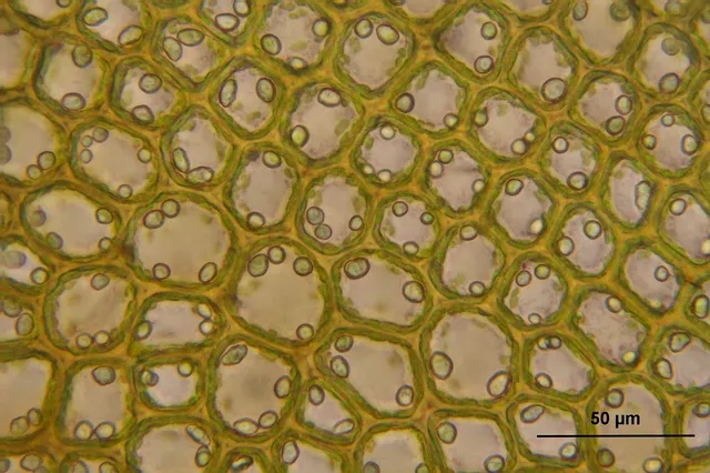 Loricate Ciliates: Tiny Armored Knights Navigating Microscopic Waters!