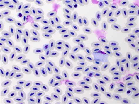  Leucocytozoon!  A Tiny Terror Lurking Within the Bloodstream of Birds